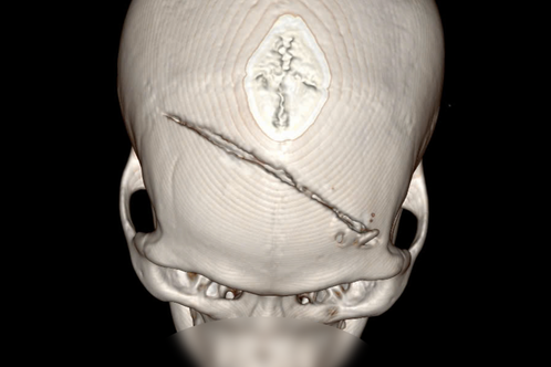 Thanh niên dập não nặng, vượt hàng trăm km đến TPHCM và cái kết vỡ oà