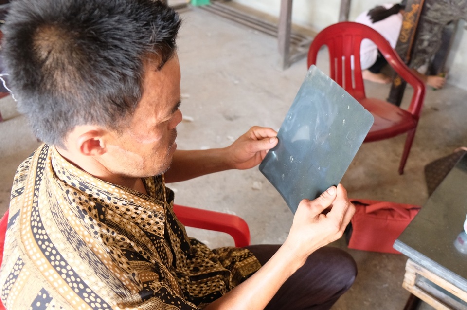 Nhói lòng cảnh vợ tàn tật nghẹn ngào cầu xin giúp chồng được phẫu thuật - 1 Nhói lòng cảnh vợ tàn tật nghẹn ngào cầu xin giúp chồng được phẫu thuật - 1