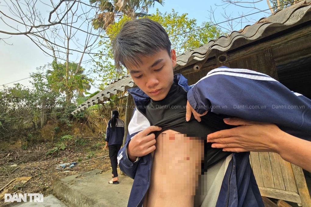 Em chỉ ước những đêm mưa gió không phải ngủ cùng rắn, rết - 4 Em chỉ ước những đêm mưa gió không phải ngủ cùng rắn, rết - 4