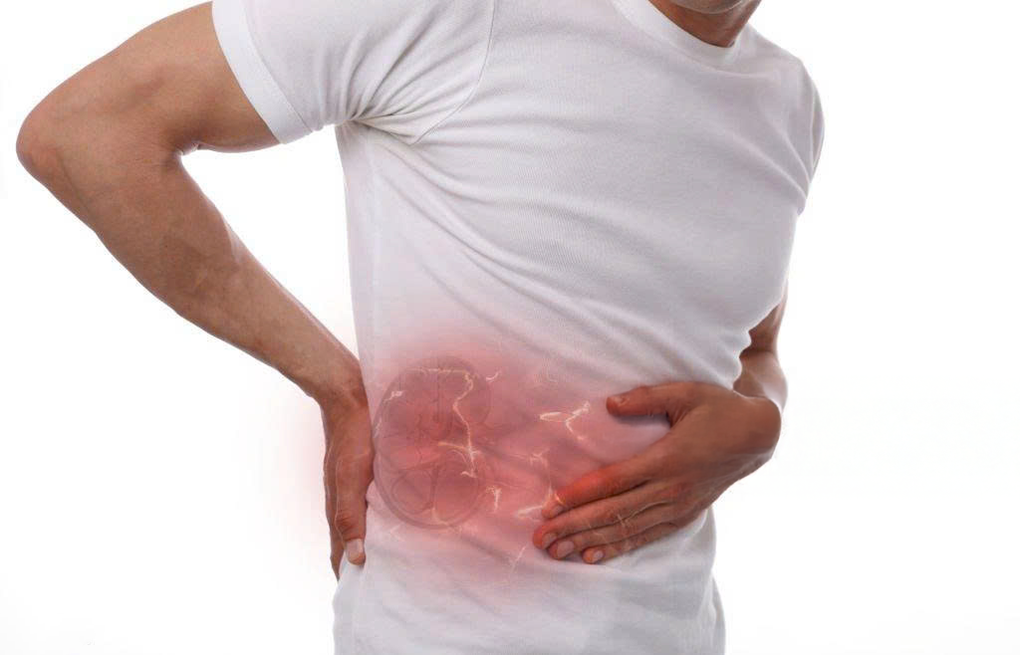 Phân biệt giữa đau bụng do sỏi với bệnh tiêu hóa - 3 Phân biệt giữa đau bụng do sỏi với bệnh tiêu hóa - 3