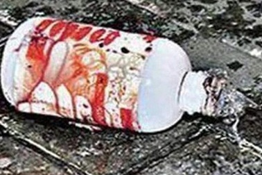 Nam thanh niên bị tạt axit khi đang chở bạn gái