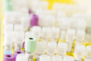 Thử máu cho phép phát hiện ung thư phổi