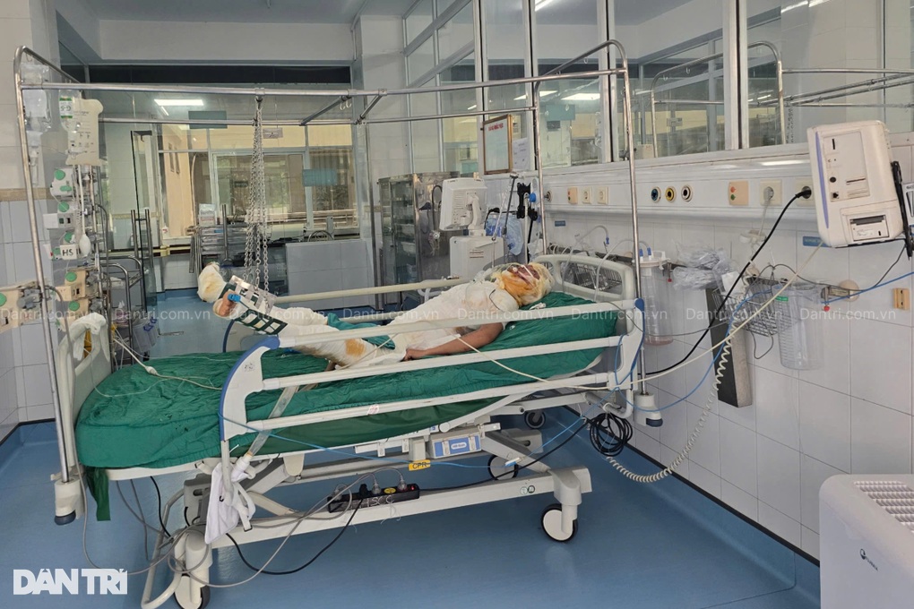 Bác sĩ kêu gọi cứu chàng trai dân tộc Mông nguy kịch vì bỏng điện - 4 Bác sĩ kêu gọi cứu chàng trai dân tộc Mông nguy kịch vì bỏng điện - 4