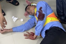 2 nhân viên trạm BOT vô cớ bị hành hung trọng thương