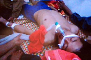 Hà Tĩnh: Cứu sống một học sinh đã chết lâm sàng do ngạt nước