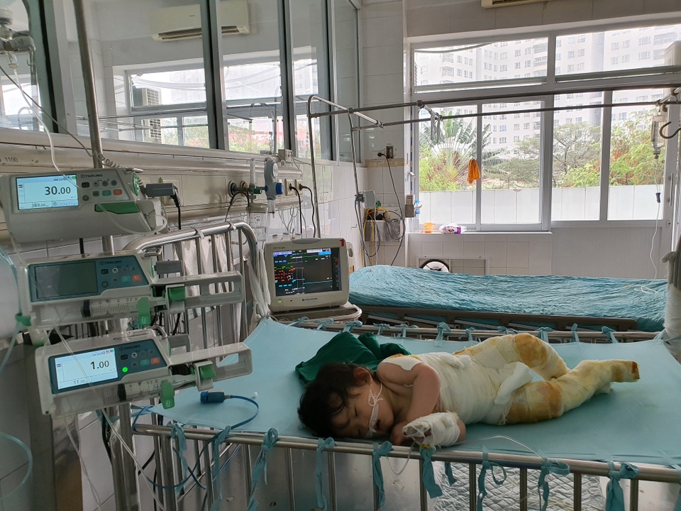 Đau nhói lòng cảnh bé gái 14 tháng tuổi ngã vào nồi nước sôi nguy kịch - 1 Đau nhói lòng cảnh bé gái 14 tháng tuổi ngã vào nồi nước sôi nguy kịch - 1