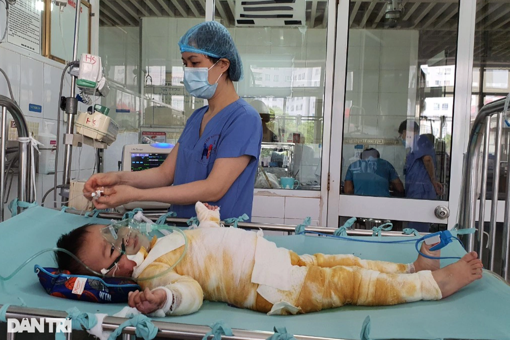 Bỏng nước sôi 66% cơ thể, bé 20 tháng tuổi nguy kịch xin cứu tính mạng - 4 Bỏng nước sôi 66% cơ thể, bé 20 tháng tuổi nguy kịch xin cứu tính mạng - 4
