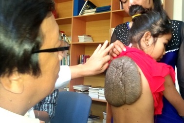 Bé gái mang bướu rùa khổng lồ cực hiếm gặp