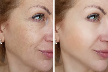 10 thực phẩm bạn nên ăn để có làn da đẹp và khỏe mạnh