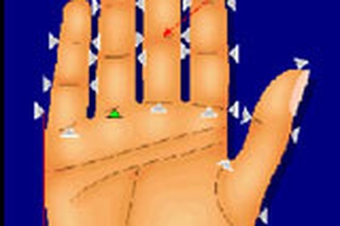 Dự đoán bệnh viêm khớp qua chiều dài ngón tay