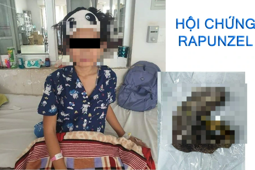 Bé gái 11 tuổi mắc hội chứng hiếm gặp, ăn cả cân tóc - 1 Bé gái 11 tuổi mắc hội chứng hiếm gặp, ăn cả cân tóc - 1