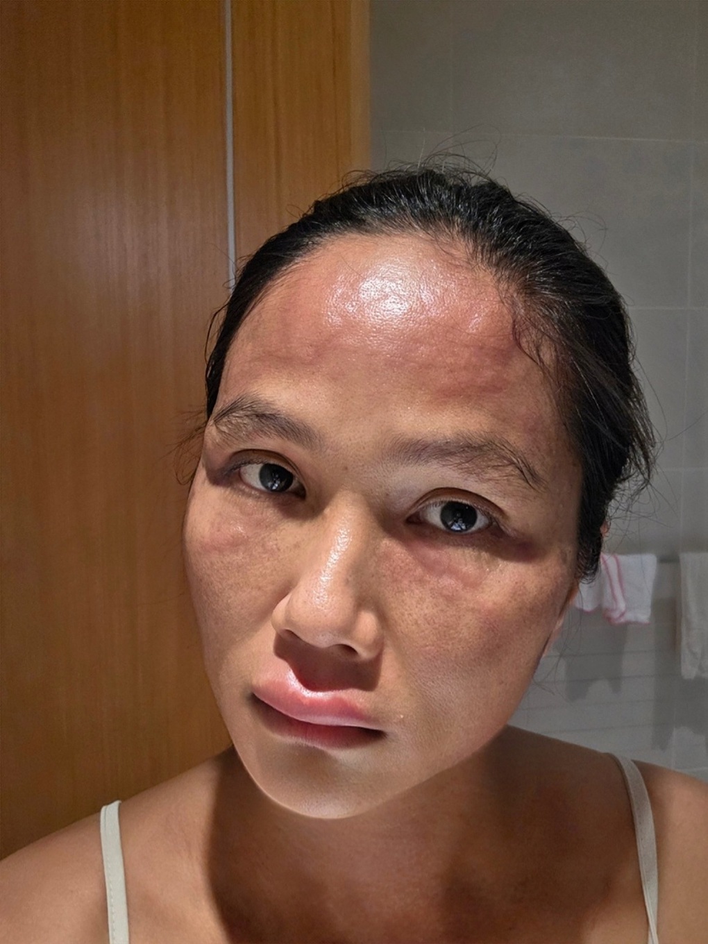 HHen Niê hé lộ gương mặt sưng tấy sau khi sinh, sức khỏe hiện ra sao? - 1 HHen Niê hé lộ gương mặt sưng tấy sau khi sinh, sức khỏe hiện ra sao? - 1