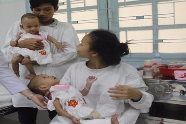 Hơn 400 ngày nằm viện cặp đôi dính liền sắp được về nhà