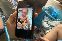 Bé trai bị đổ nước sôi, châm thuốc: Xem xét việc tách trẻ khỏi bố mẹ