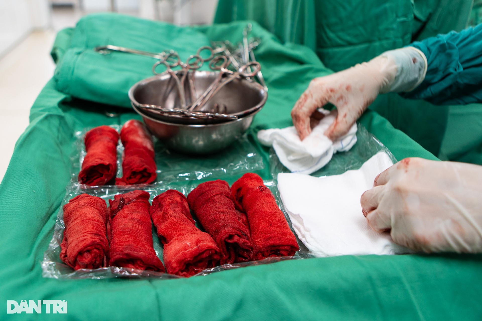 Nghẹt thở cuộc đua máu trong phòng mổ cấp cứu sản khoa - 17 Nghẹt thở cuộc đua máu trong phòng mổ cấp cứu sản khoa - 17