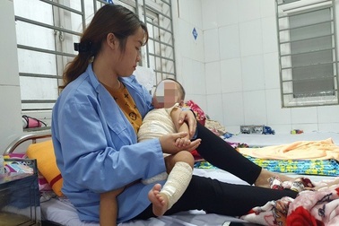 Tin tưởng thầy lang chữa bỏng… con bị hoại tử da