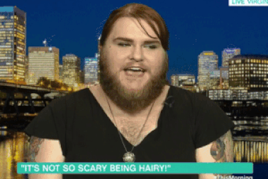 Cô gái nuôi râu tự tin xuất hiện trên sóng truyền hình