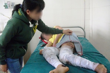 Chồng tạt xăng đốt vợ