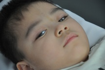 Ánh mắt cầu cứu sự sống của bé 3 tuổi bị viêm não