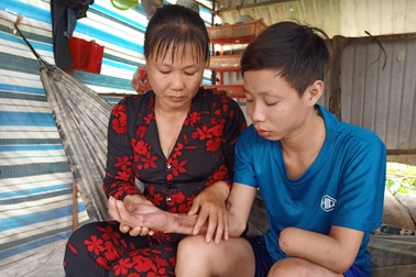 Xót xa chàng trai 18 tuổi bị tai nạn điện giật cụt tay