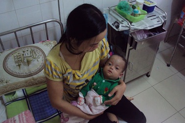 Mong manh sự sống của bé sinh non ở tháng thứ 7 