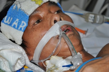 Anh Nguyễn Văn Đức bị viêm tụy cấp đã không còn