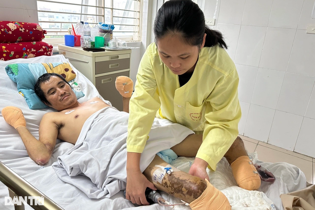 Đau lòng cảnh sống không bằng chết của người cha bị cắt cụt chân tay - 6 Đau lòng cảnh sống không bằng chết của người cha bị cắt cụt chân tay - 6