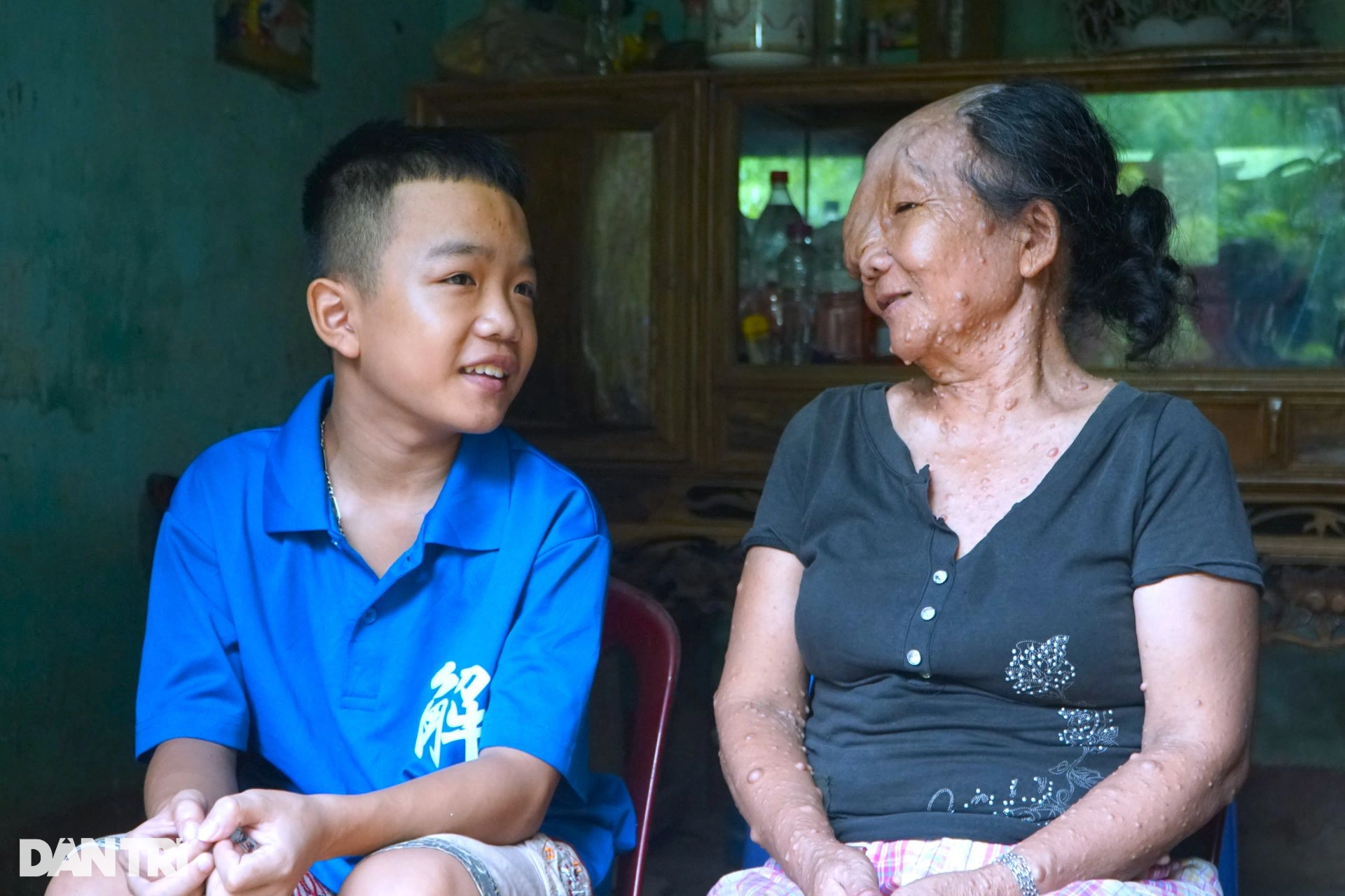 Sóng gió cuộc đời người đàn bà mang khuôn mặt quỷ - 6 Sóng gió cuộc đời người đàn bà mang khuôn mặt quỷ - 6