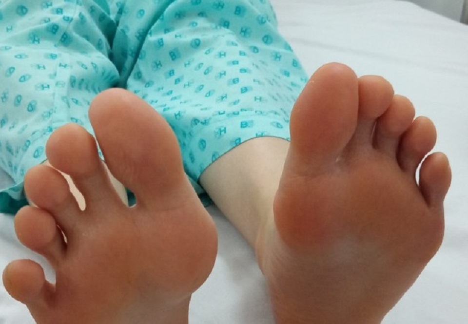 Giải pháp mới giúp điều trị tình trạng đổ mồ hôi chân - 2 Giải pháp mới giúp điều trị tình trạng đổ mồ hôi chân - 2
