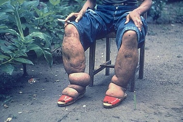 Những căn bệnh khủng khiếp rình rập du khách trên đường du lịch