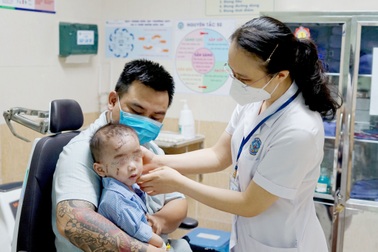 Vỡ bình thủy tinh đựng nước, bé trai bị nhiều dị vật cắm vào mặt