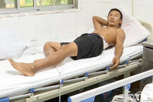 Hy hữu người đàn ông bị sét đánh 2 lần trong 5 phút