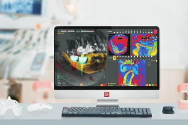 Công nghệ trồng răng implant mới tại Nha khoa Kim