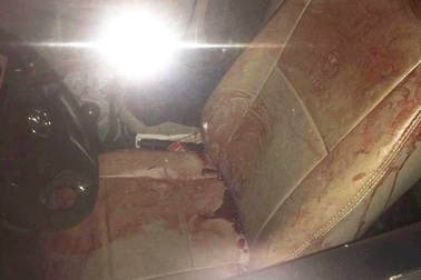 Tài xế taxi bị cướp đâm trọng thương trong đêm