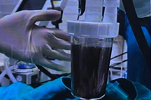 Thiếu tá biên phòng phổi ám đen sau vụ cháy, hội chẩn chuyên gia nước ngoài