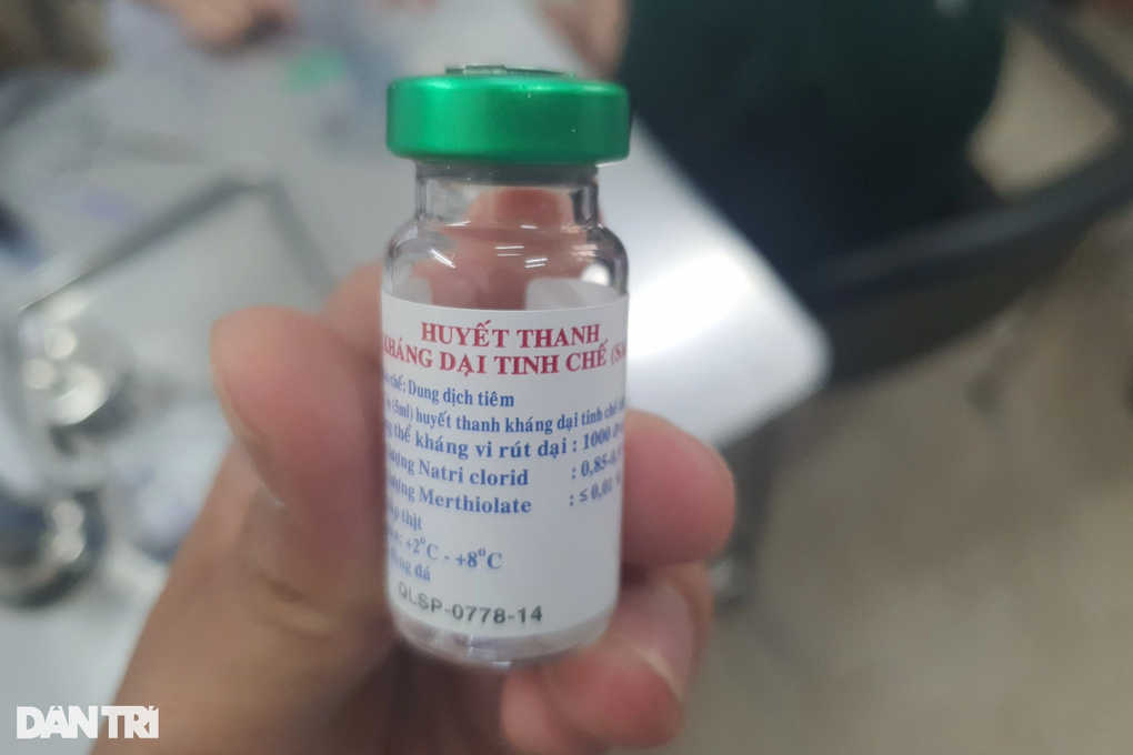 Bệnh viện ở TPHCM liên tiếp ghi nhận 2 bé viêm não nguy kịch vì bệnh dại - 2 Bệnh viện ở TPHCM liên tiếp ghi nhận 2 bé viêm não nguy kịch vì bệnh dại - 2