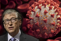 Bill Gates dương tính với virus SARS-CoV-2