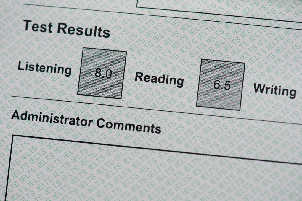 Chinh phục IELTS đúng cách giúp hành trình săn học bổng nhẹ nhàng hơn - 1 Chinh phục IELTS đúng cách giúp hành trình săn học bổng nhẹ nhàng hơn - 1