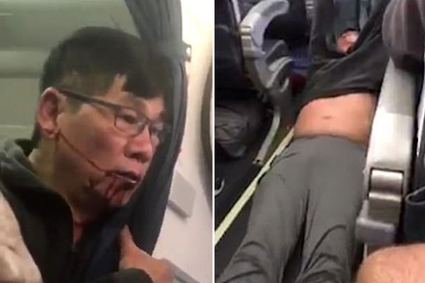 Ám ảnh tiếng la hét trong vụ bác sĩ gốc Việt bị lôi khỏi máy bay