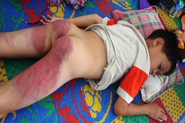 3/4 trẻ dưới 14 tuổi bị người lớn trừng phạt bằng bạo lực