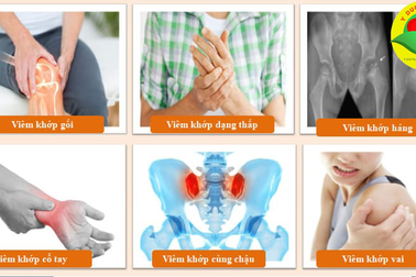 Xương khớp Tâm An: giải pháp dành cho người bệnh xương khớp