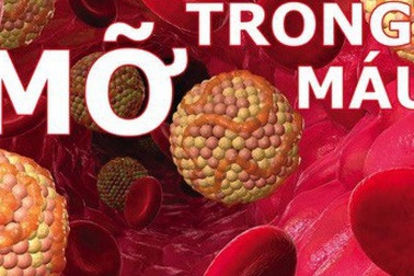 Trắc nghiệm về mối nguy hiểm của mỡ máu