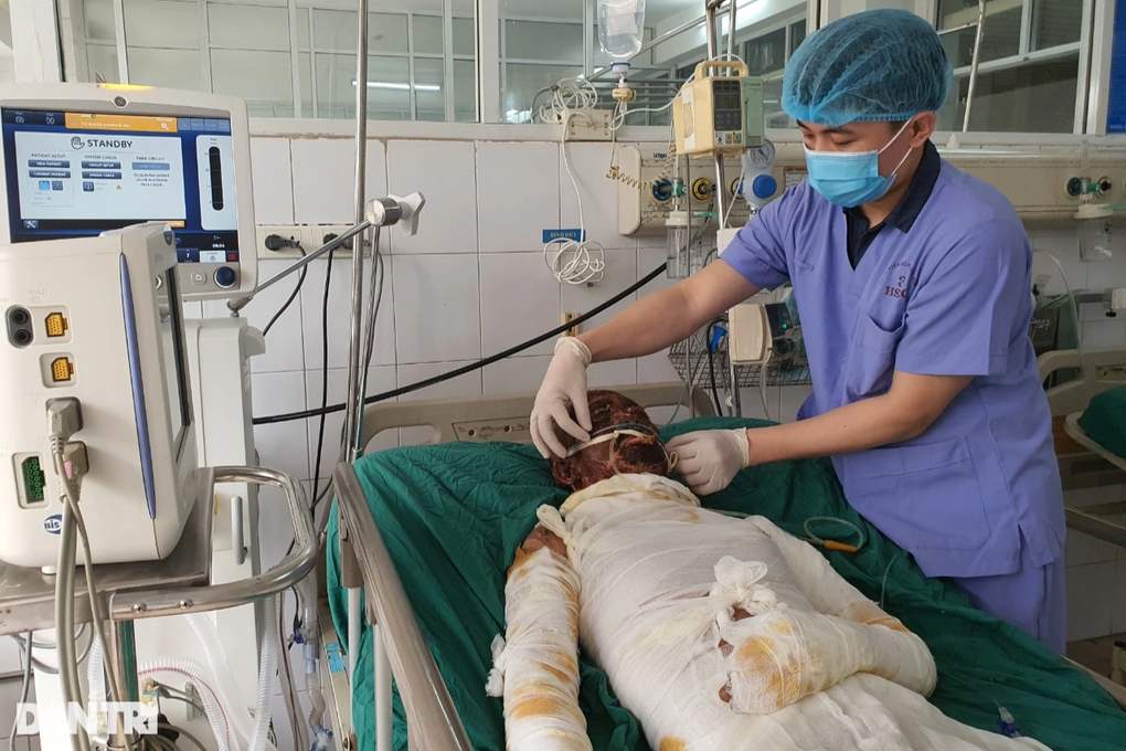 Người đàn ông bị bỏng gas khóc xin cứu em với, em còn chưa báo hiếu mẹ… - 2 Người đàn ông bị bỏng gas khóc xin cứu em với, em còn chưa báo hiếu mẹ… - 2