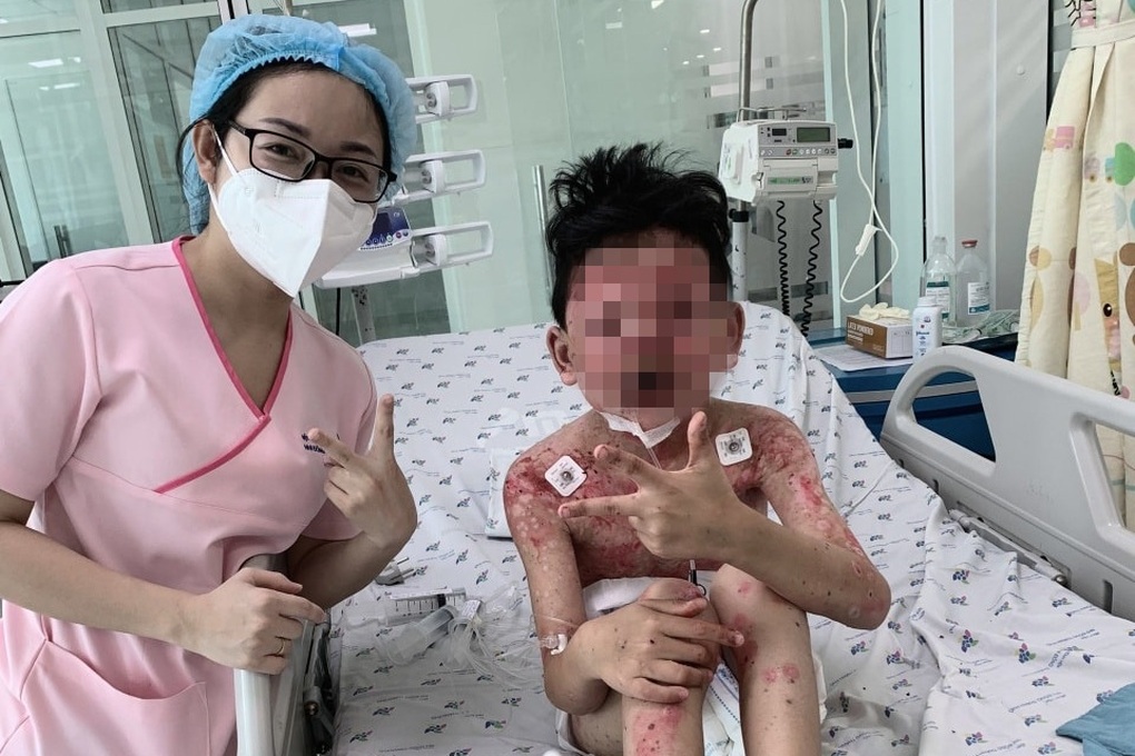 Bé trai 8 tuổi lở loét khắp người, nhiễm trùng nặng nề sau khi ăn cua - 3 Bé trai 8 tuổi lở loét khắp người, nhiễm trùng nặng nề sau khi ăn cua - 3