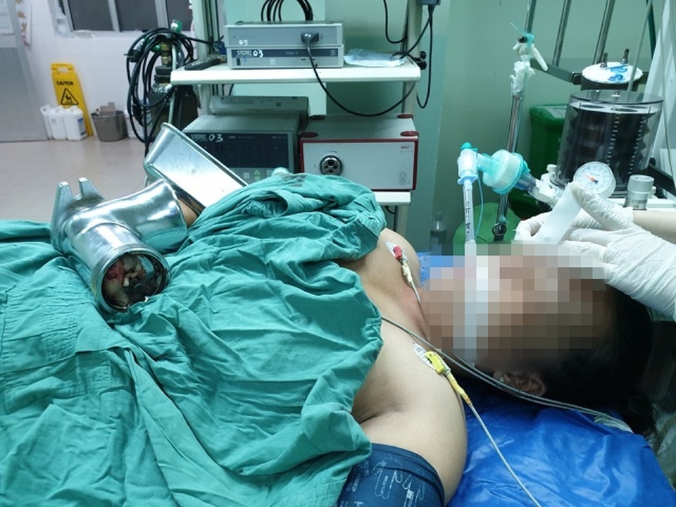 Người phụ nữ bị dập nát bàn tay vì máy xay cá cuốn vào - 1 Người phụ nữ bị dập nát bàn tay vì máy xay cá cuốn vào - 1