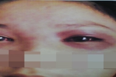 Hà Nội: Thiếu nữ phố núi bị cưỡng bức, rạch tay khẩn thiết kêu cứu