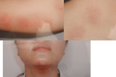 UBND huyện Bình Sơn chậm hồi âm vụ cô giáo bị chồng bạo hành