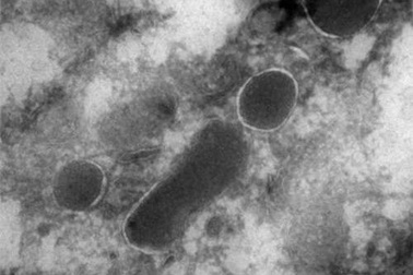 Phát hiện rùng mình về sinh vật sống trong tế bào ung thư