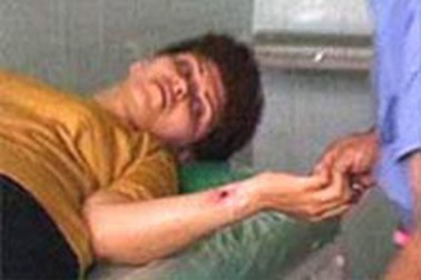 Cô gái biến thành cây xương rồng