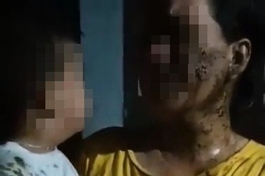 Truy tố chủ nợ tạt phân gà và dầu lửa lên đầu con nợ cùng bé trai 2 tuổi